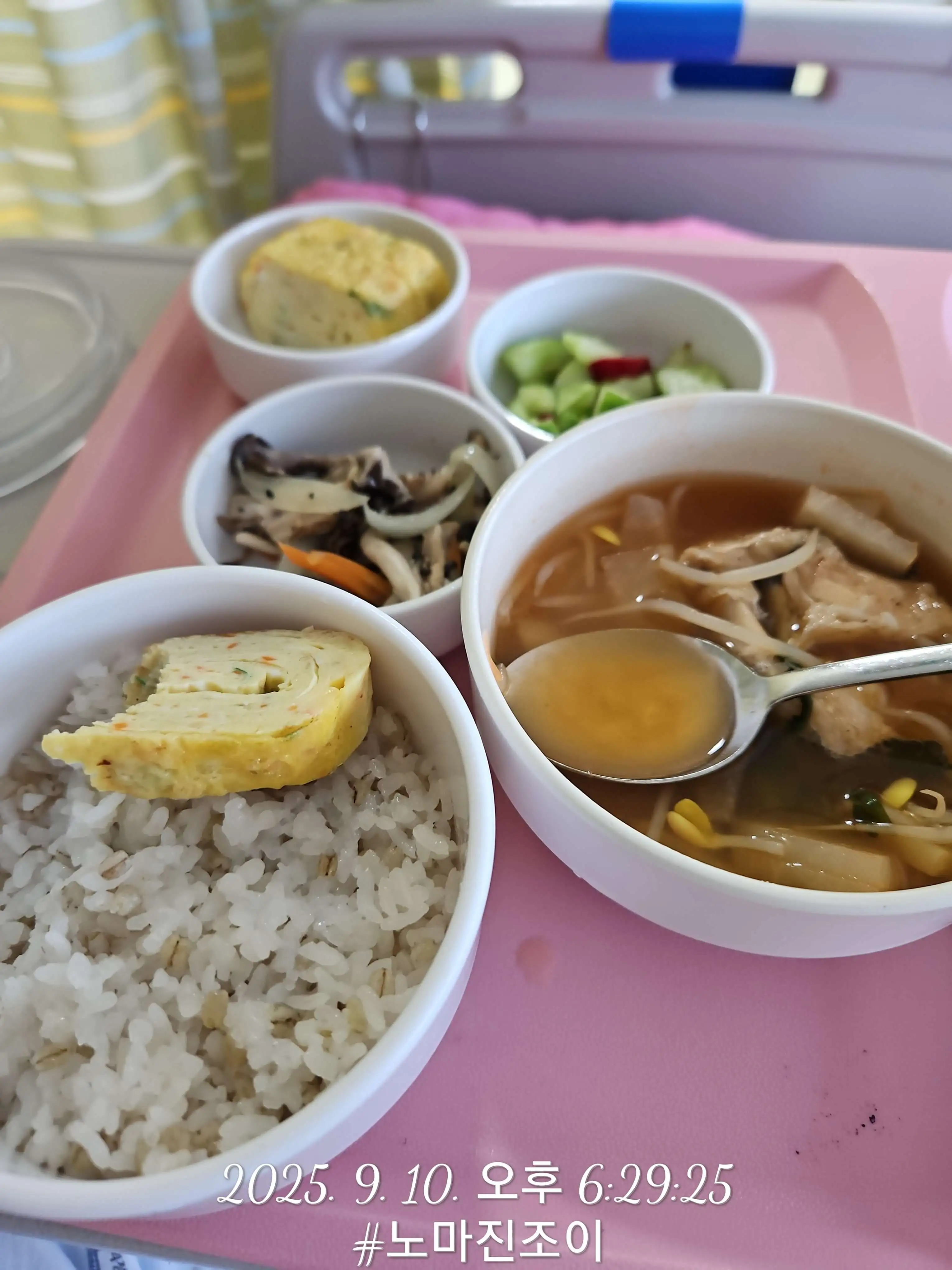 [성모병원 수술후기] 선천성 이루공 전신마취 수술&amp;#44; 의정부성모병원 입원 리얼경험