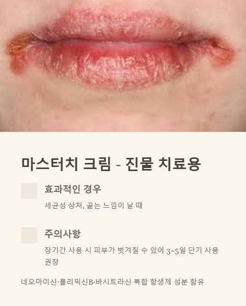 마스터치 크림 진물 치료용