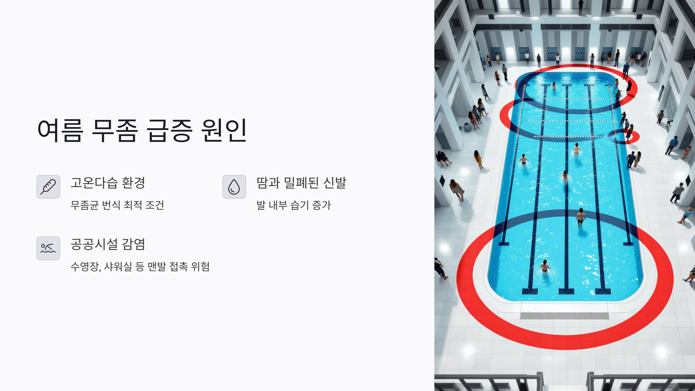 여름 무좀 급증 원인과 공공시설 감염 주의점