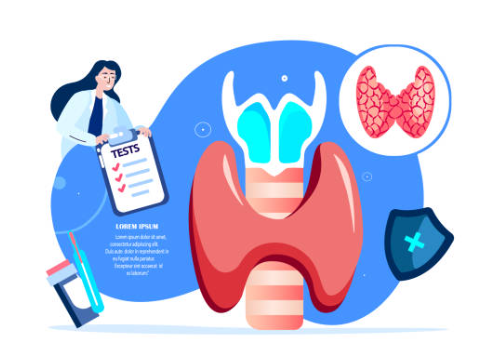 갑상선 기능 항진증