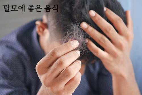 탈모에 좋은 음식 알아보기&amp;#44; 탈모 원인