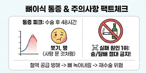 임플란트 뼈이식 통증 주의사항