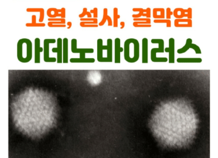 아데노바이러스