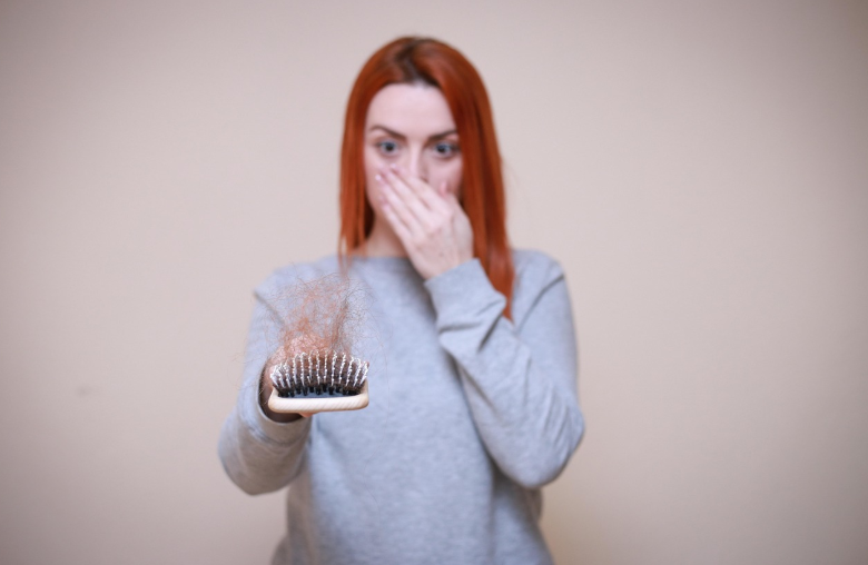 탈모에 관련된 사진