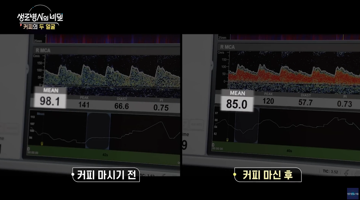 생로병사의비밀 건강하게커피마시기 각성효과 카페인 아데노신 카와웰 항암효과 당뇨병 항산화력