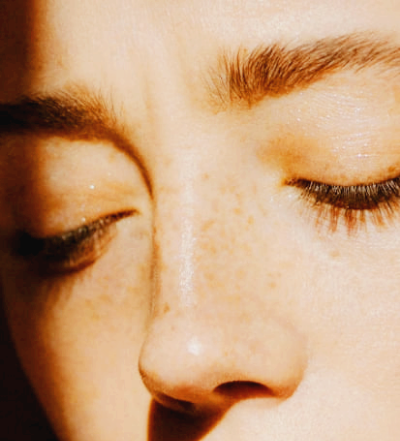 햇빛 알레르기 증상과 없애는방법