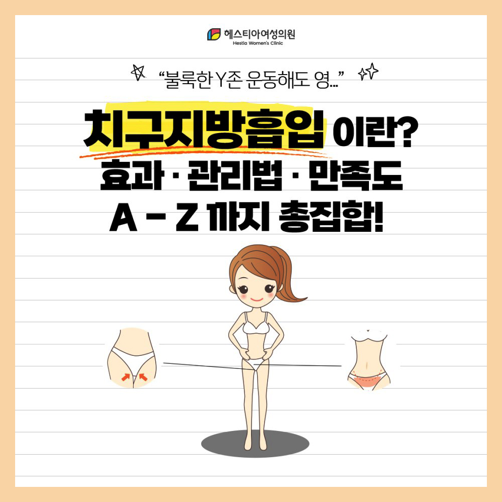 Y존부각 치구성형수술로 관리하세요! 치구지방흡입 A-Z까지 총정리