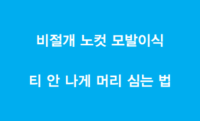 비절개 노컷 모발이식 - 티 안 나게 머리 심는 법