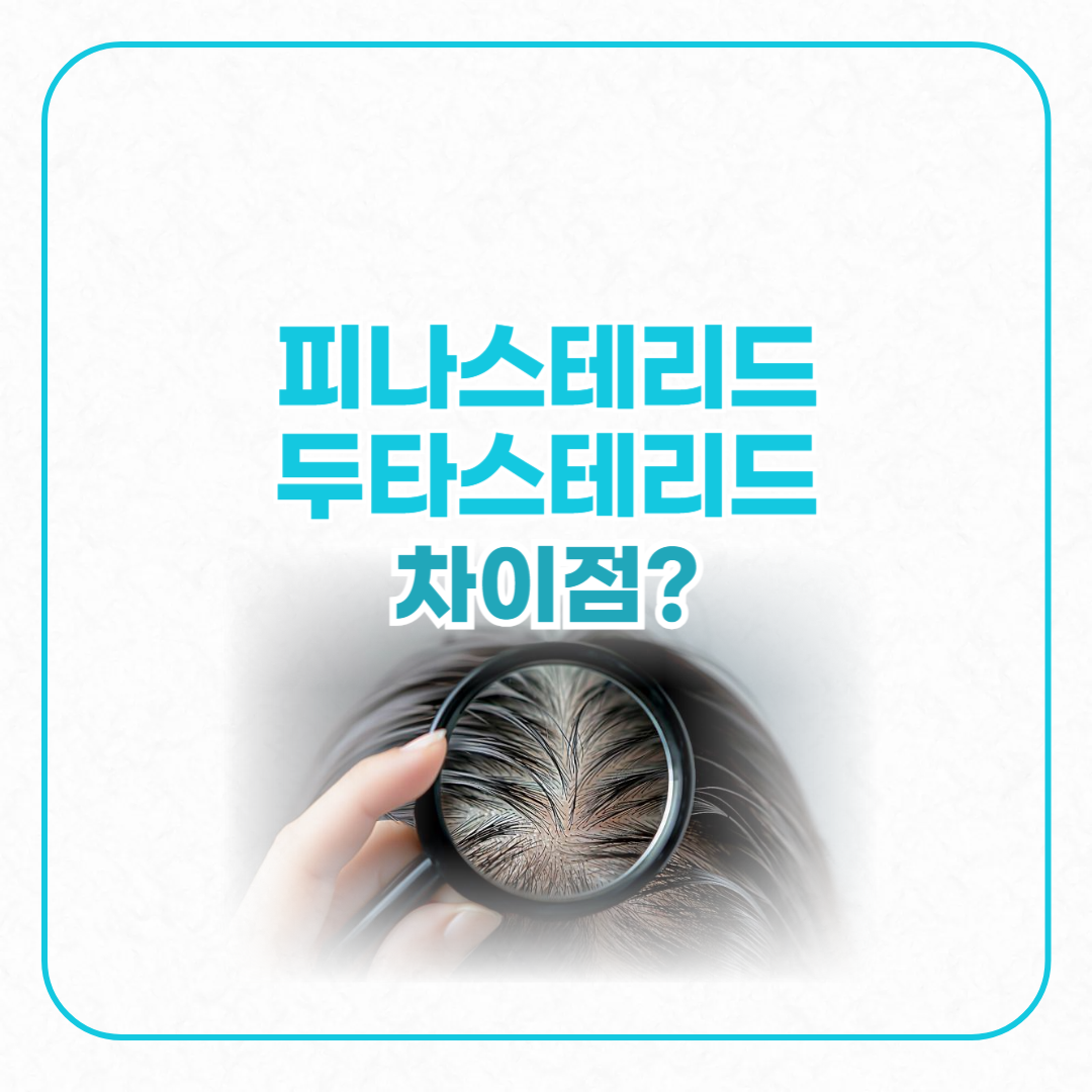 두피가보이는 여자 탈모