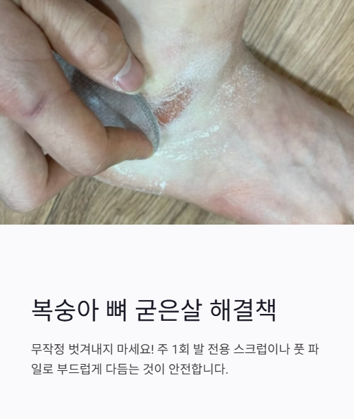 복숭아 뼈 굳은살 해결책