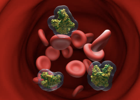 다한증 치료 원인 수술 다한증에 좋은 음식 총정리