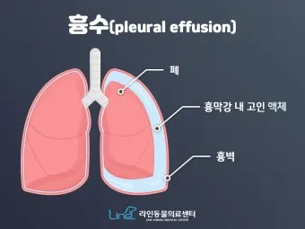폐에 물이 차는 원인 증상 물참 관리 포인트에 대한 건강정보_4
