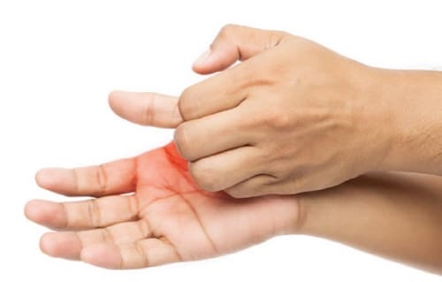 한포진의원인과증상