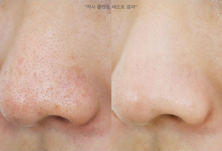 마녀공장 네고왕