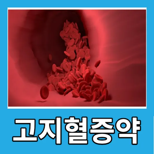 고지혈증약 종류 8가지 고지혈증 약 부작용 고지혈증 효과 LDL