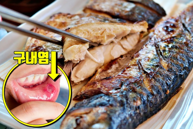 입안이 자주 헐때 좋은 음식 고등어 효능,입병이 자주나는 이유