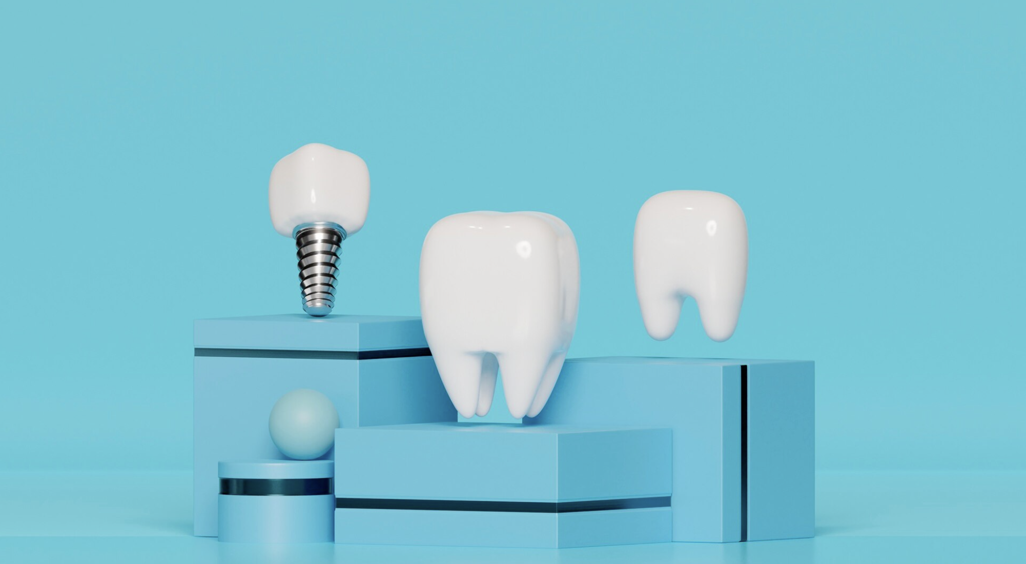 임플란트 틀니 종류 수명 장단점 관리법 건강보험 2026 최신정보