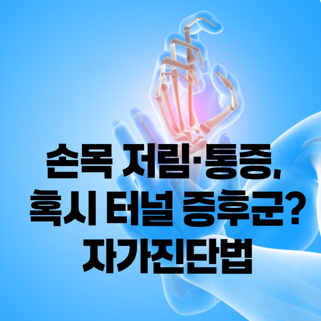 손목터널증후군 자가진단법