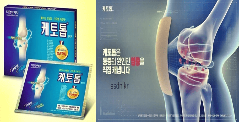 케토톱 효능 효과,성분,가격,부작용 총정리