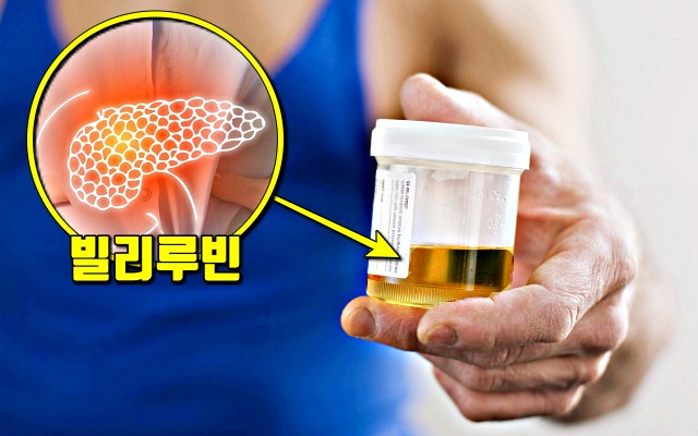 췌장암 증상 갈색소변,췌장암 초기증상,췌장암 자가진단,팁줌