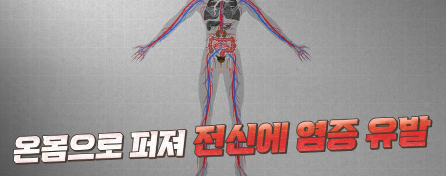 콘드로이친 효능