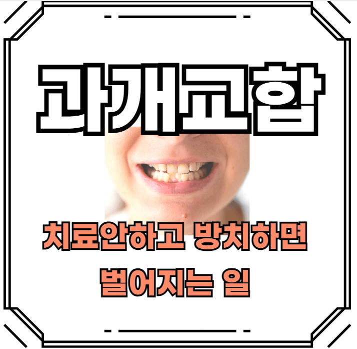 과개교합-치료-안하면