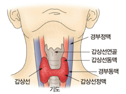 갑상선암 원인, 증상, 검사, 수술