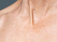 피부가려움증의 원인 4