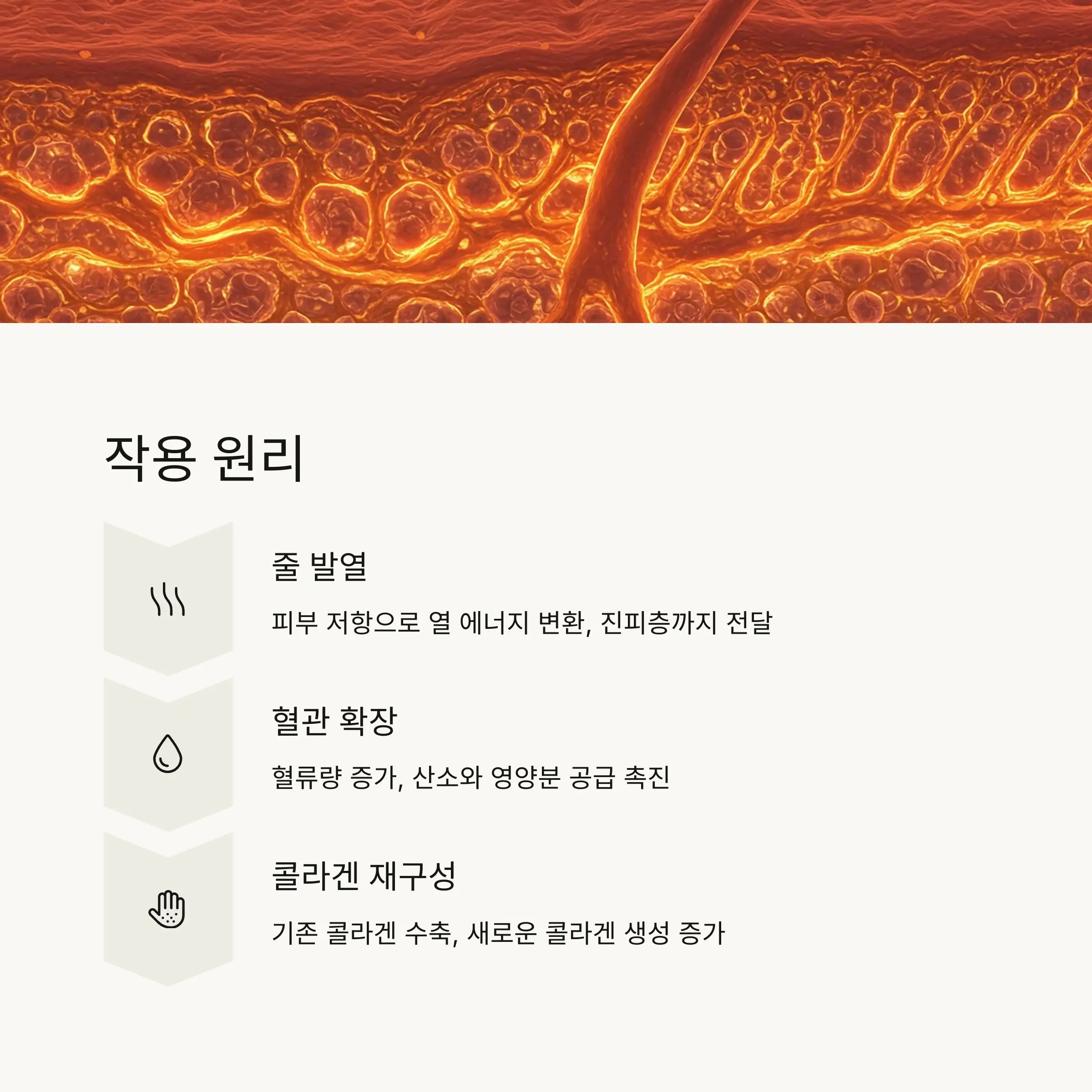 ⚡ 고주파 마사지기 작용 원리