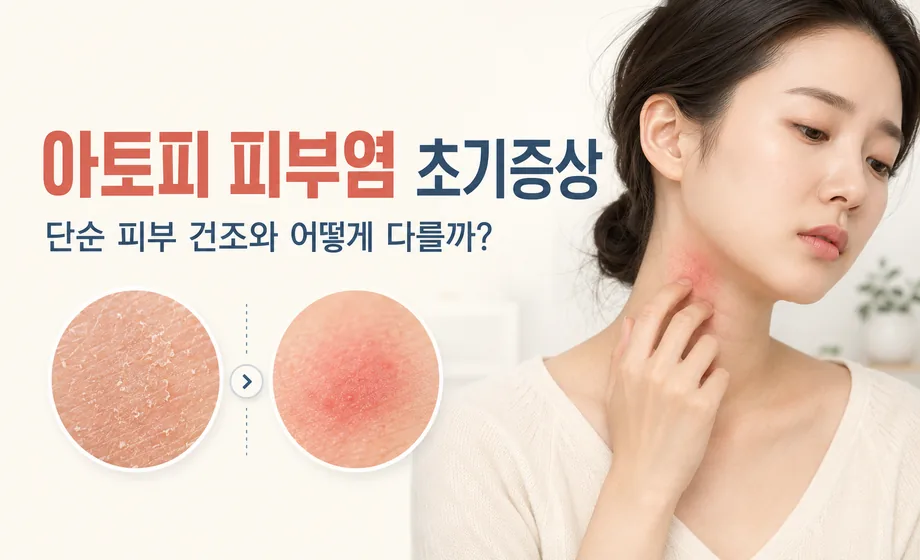 아토피 피부염 초기증상과 단순 피부 건조 차이