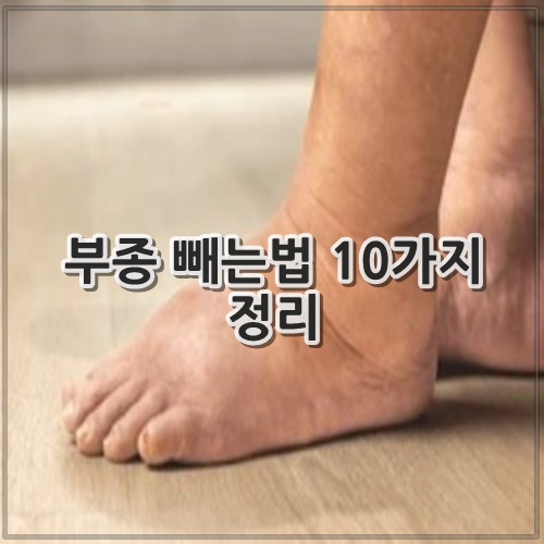 부종 빼는법 10가지 정리