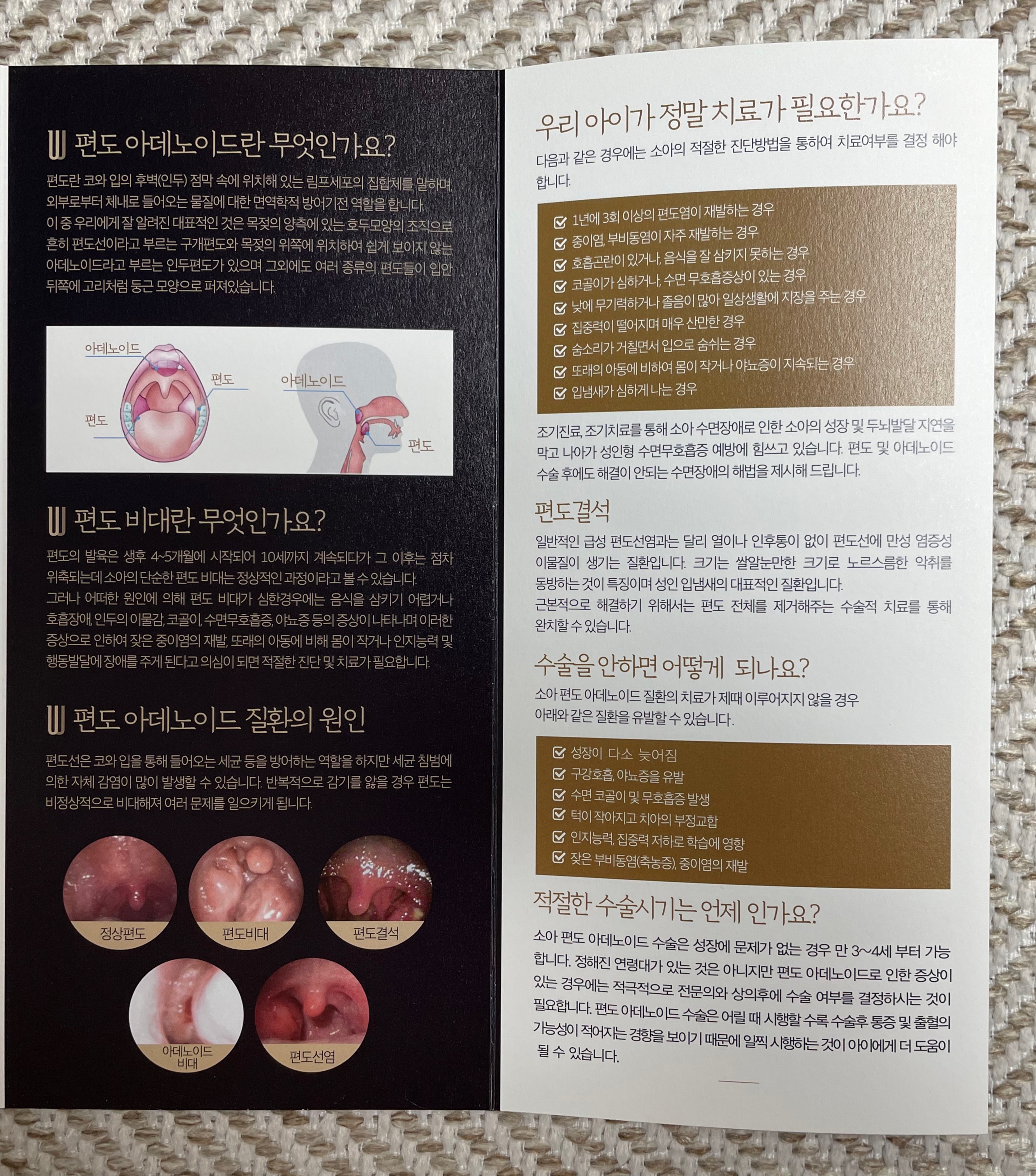 영동 더웰 이비인후과 편도선 절제 수술 안내