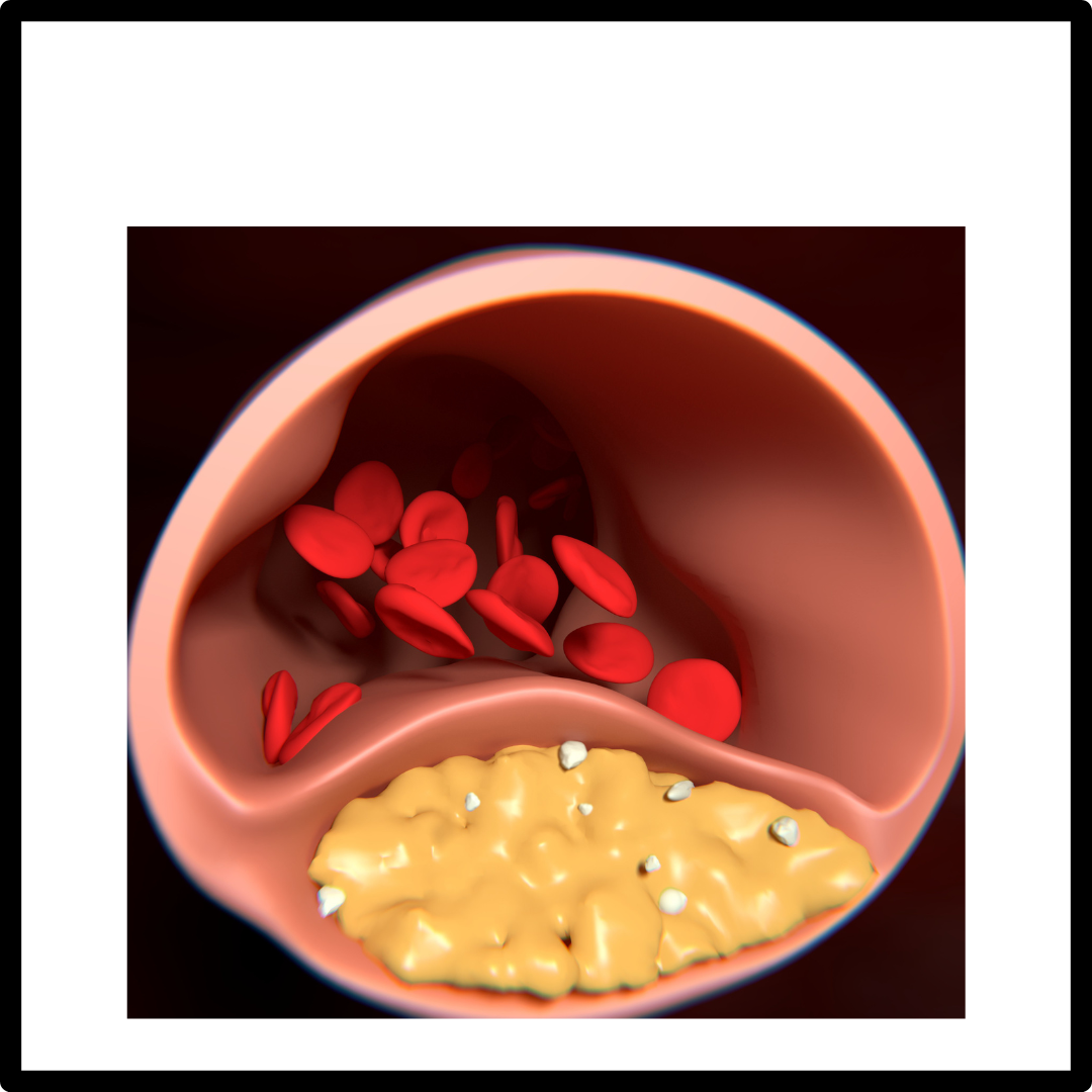 오메가-3 건강 효과와 보관 방법