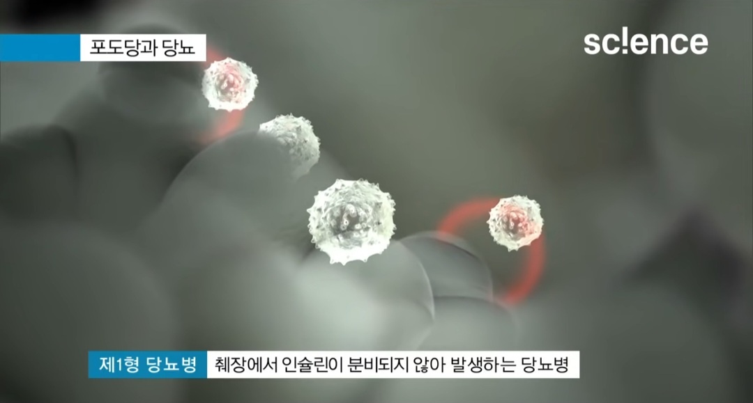 당뇨병 초기증상
