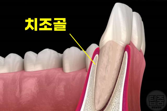 폐경 후 여성 질환 질병 잇몸 치주