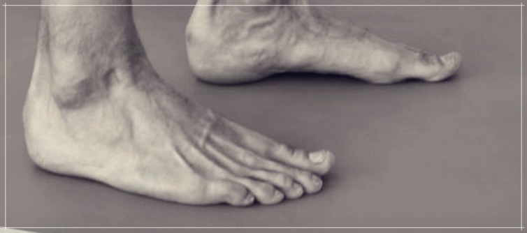 발톱 두꺼워지는 원인과 대처법