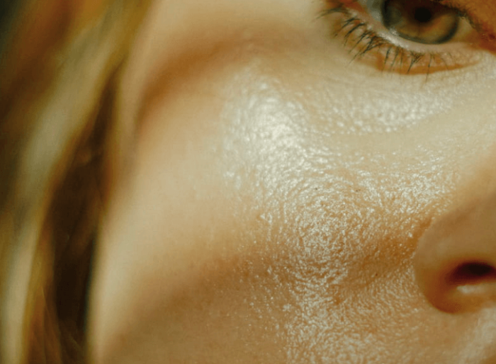 지성 피부 관리