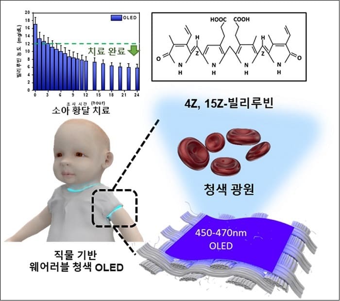 카이스트, 입을 수 있는 OLED로 소아 황달 치료기술 개발​