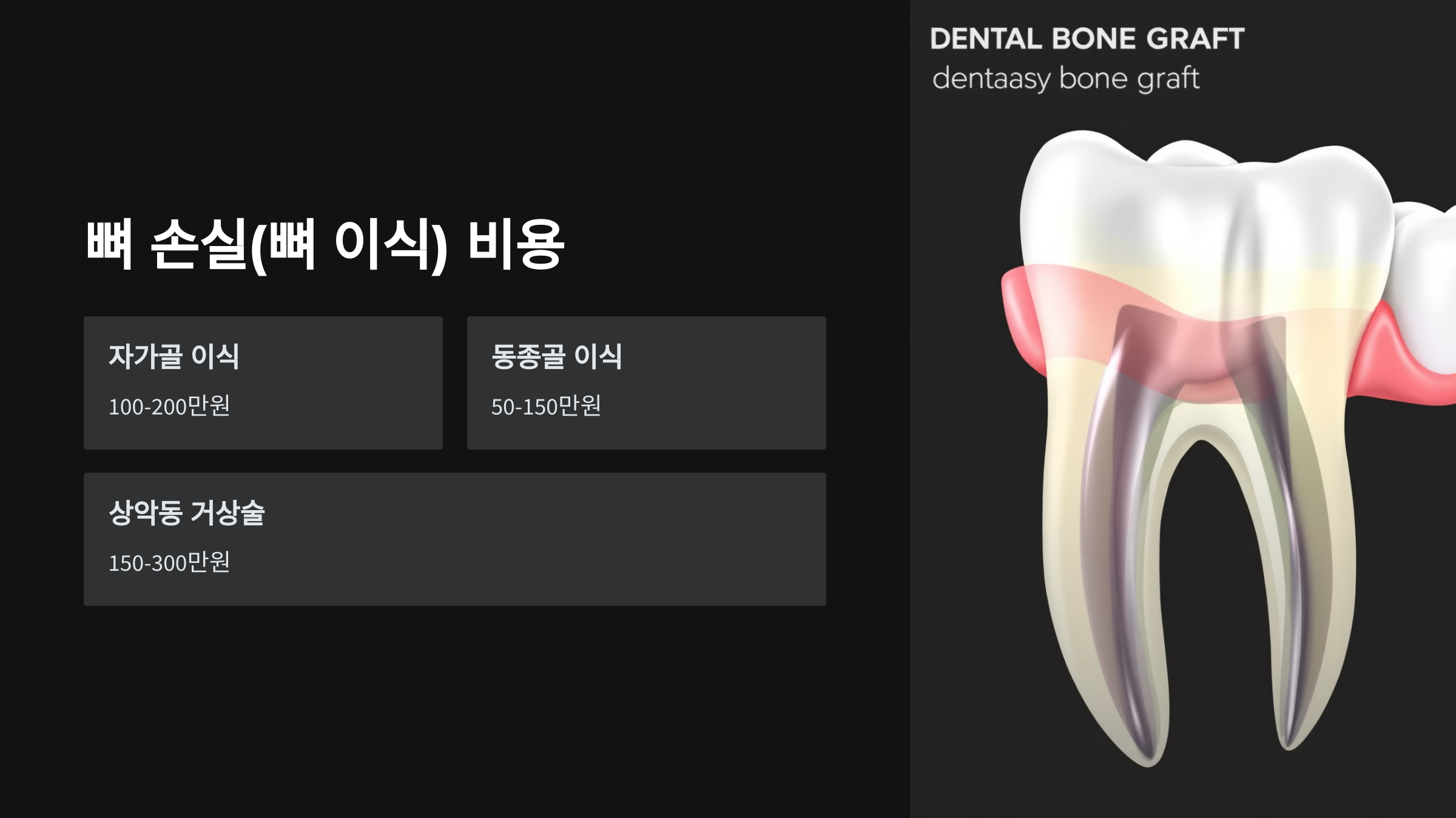 뼈 손실(뼈 이식) 비용