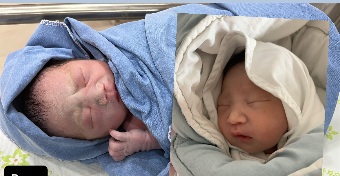 첫 째랑 너무 닮은 둘 째