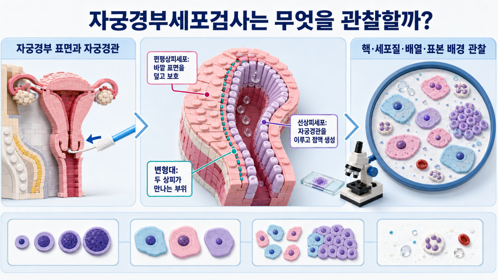 자궁경부 표면과 자궁경관의 편평상피세포&middot;선상피세포, 변형대와 현미경 관찰 항목을 설명한 인포그래픽