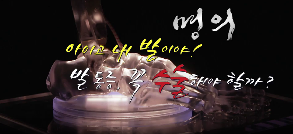 명의 발통증 족저근막염