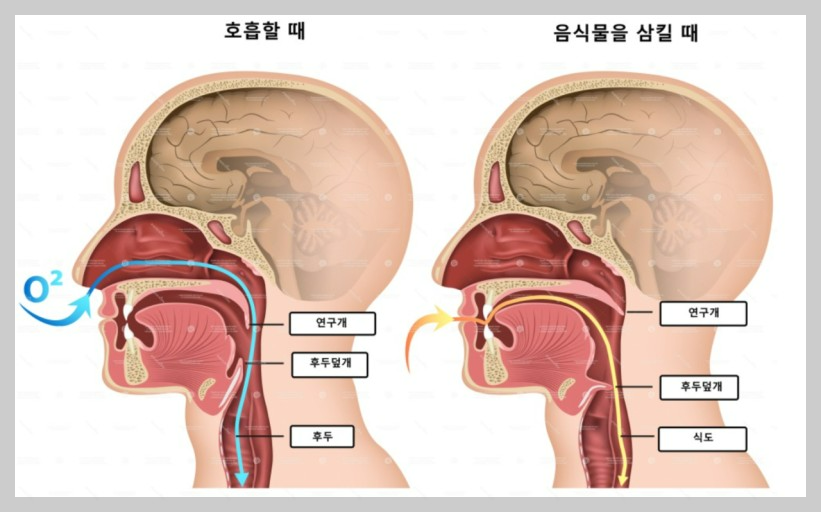 후두염 (Laryngitis) 이해하기