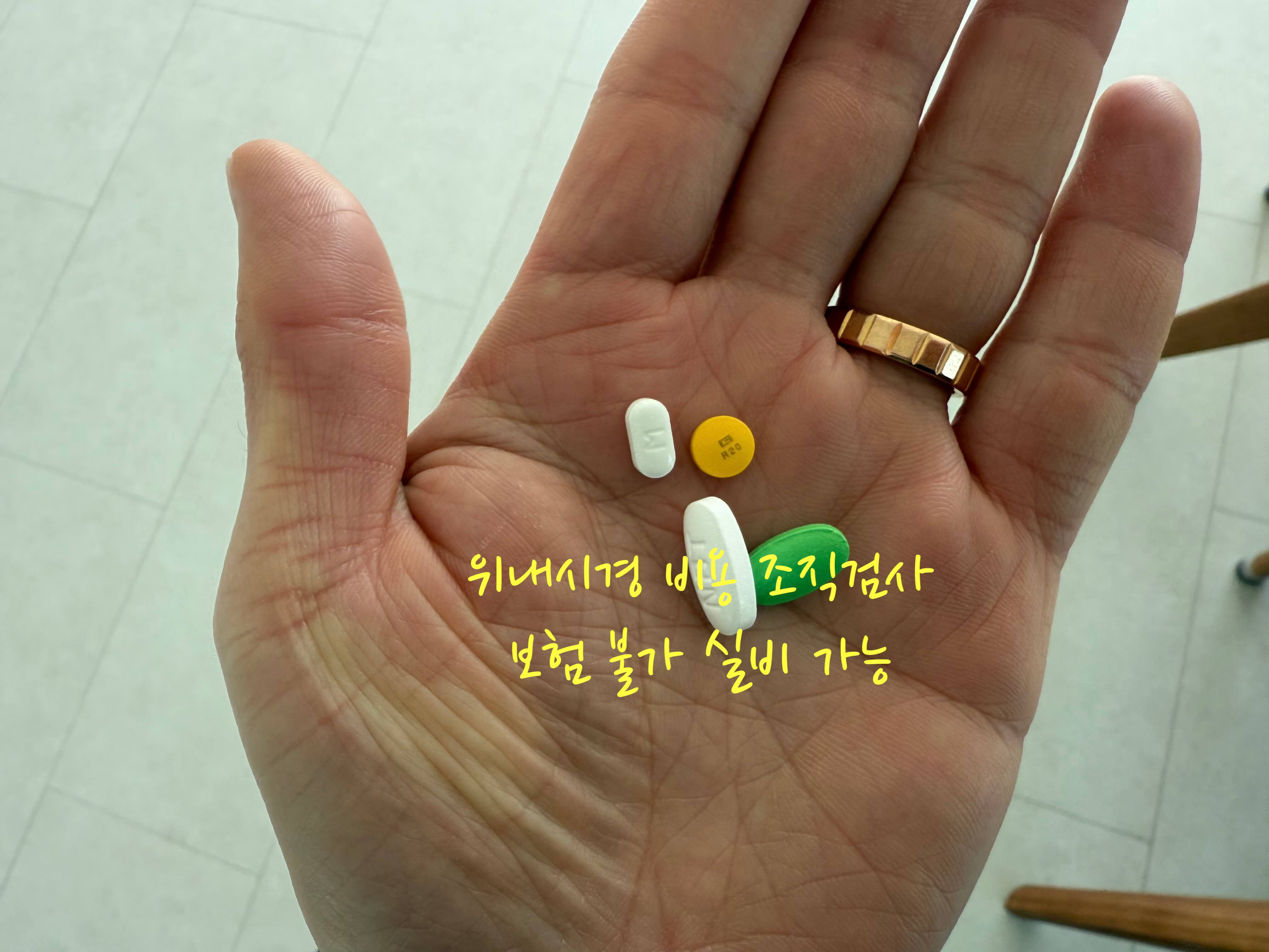위내시경 비용