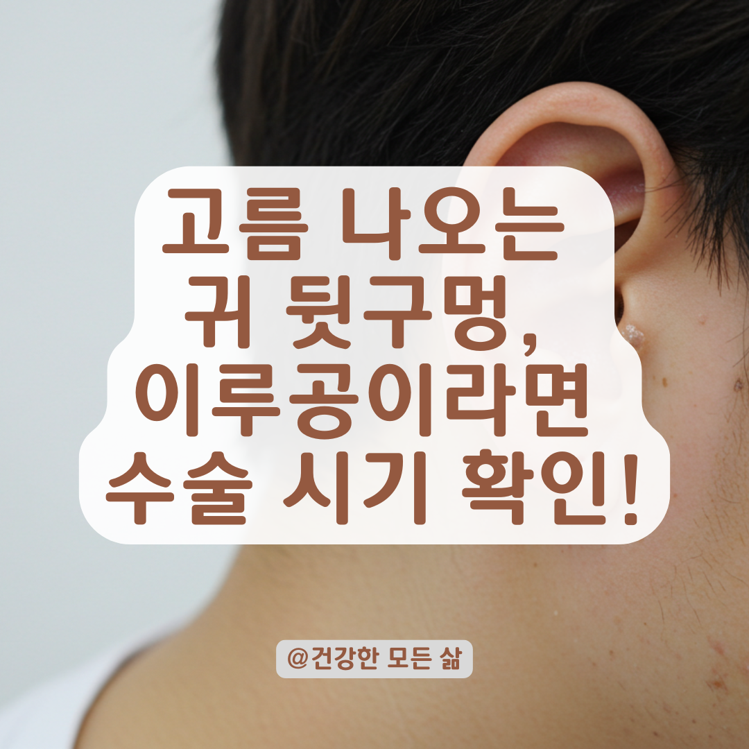 수년째 고름 나오는 이루공, 수술 꼭 해야 하는 이유와 시기 정리.