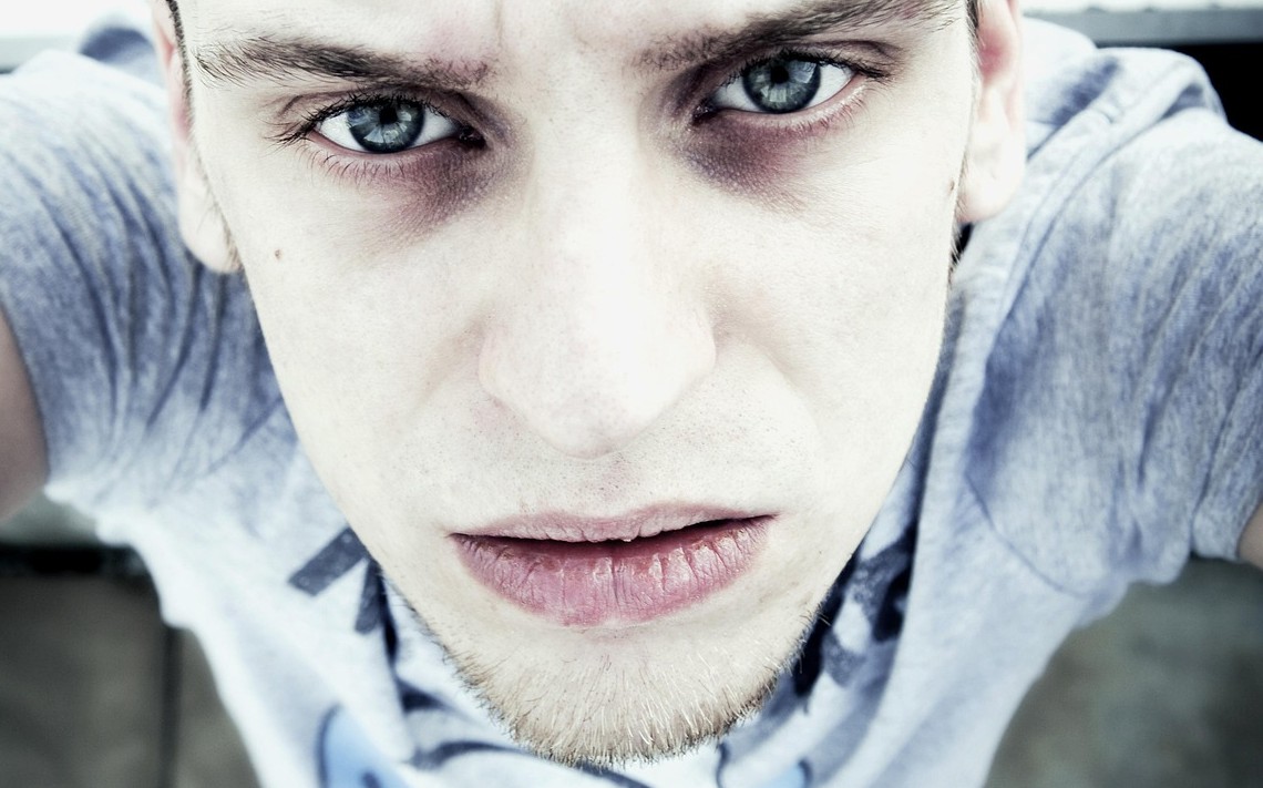 갑상선 기능 저하증