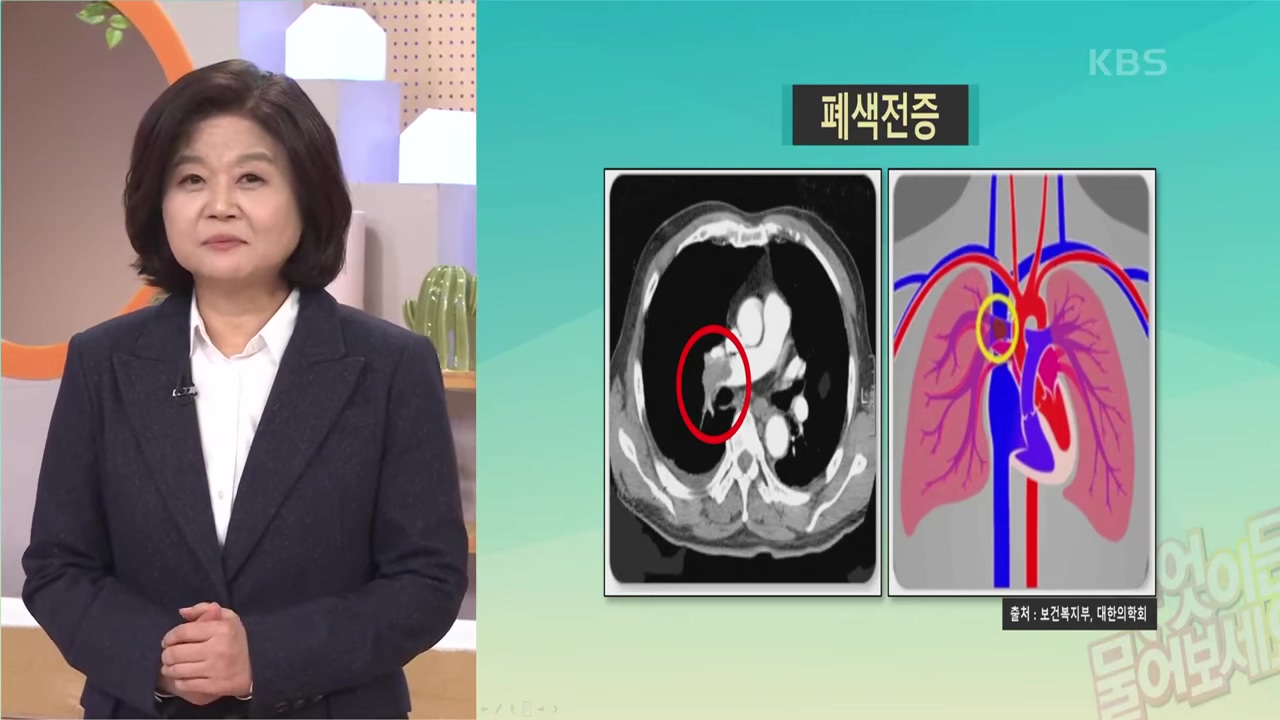 심장 콕콕 쑤시는 통증 가슴 갈비뼈 손가락으로 누르면 아픈거 이거 하나면 사라집니다