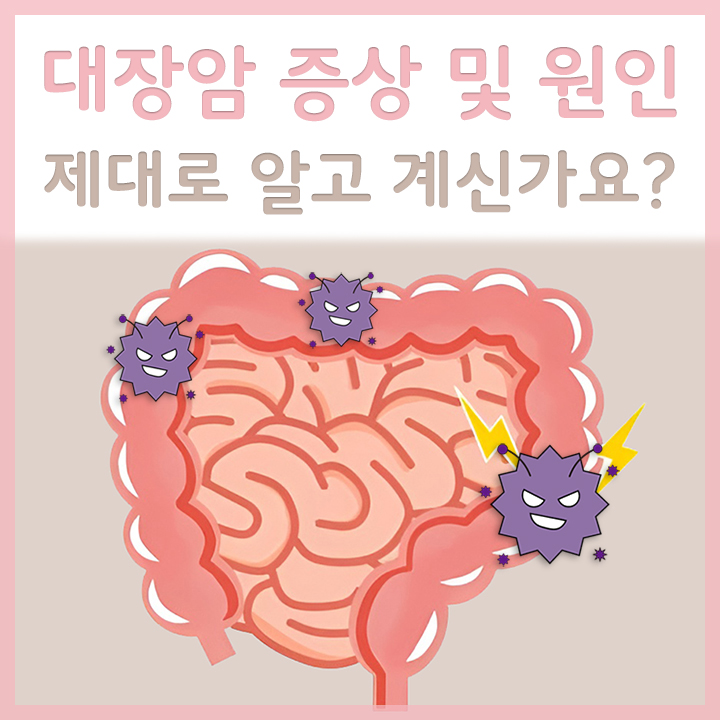 대장암의-발생-모습