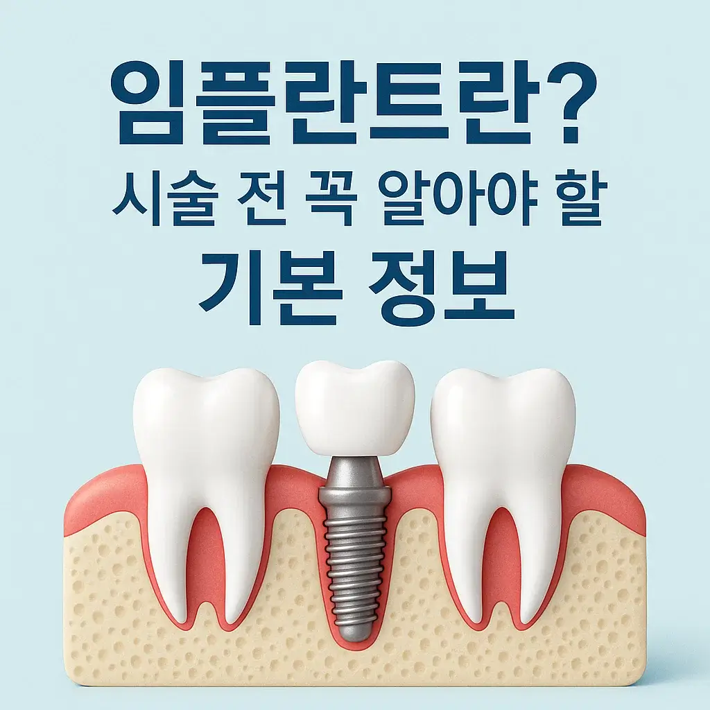 [1편] 임플란트 부작용 막으려면? 시술 전 꼭 알아야 할 핵심 가이드