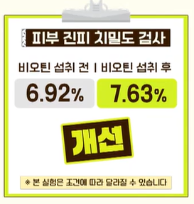 비오틴 효능
